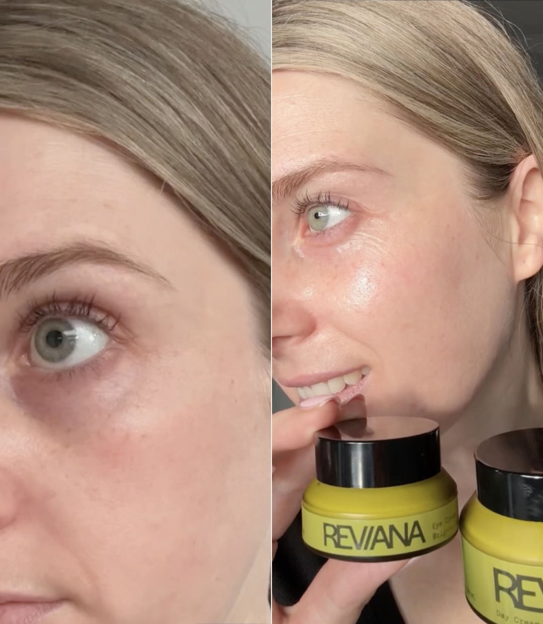 A customer's under-eye area before and after using the eye cream